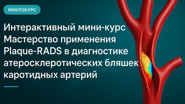 Интерактивті шағын курс. Каротидті артериялардың атеросклероздық бляшкаларын диагностикалауда Plaque-RADS қолдану шеберлігі