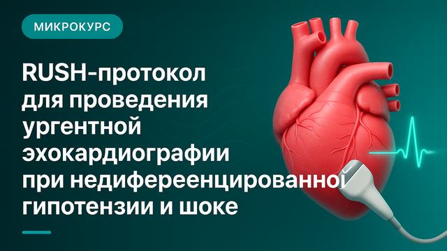 RUSH protocol for performing urgent echocardiography in undifferentiated hypotension and shock