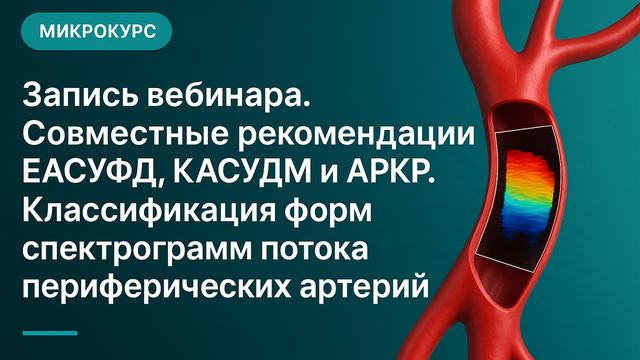Вебинар жазбасы. ЕАСУФД, ҚАСУДМ және АРКР бірлескен ұсыныстары. Перифериялық артериялар ағынының спектрограммалары формаларының жіктелуі