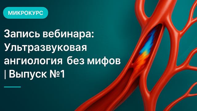 Запись вебинара: Ультразвуковая ангиология без мифов | Выпуск №1