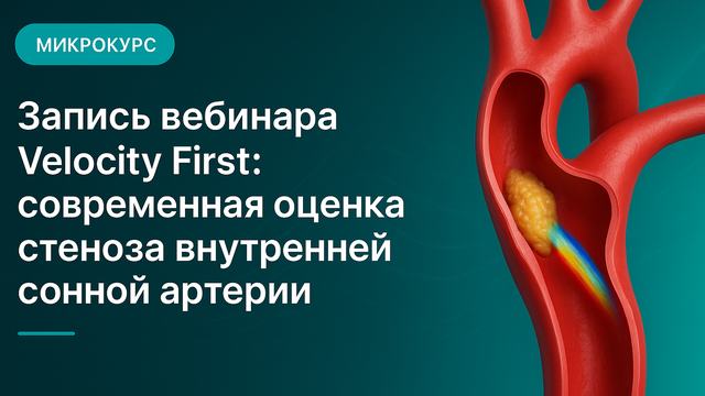 Запись вебинара Velocity First: современная оценка стеноза внутренней сонной артерии
